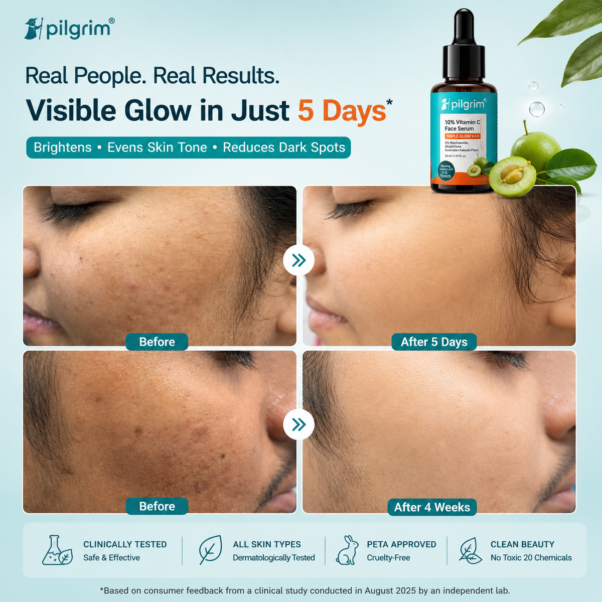 10% Vitamin C Face Serum For Triple Glow+++(Buy 1 Get 1 Free)